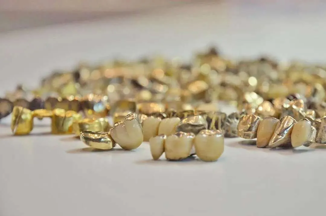 Cleor Oro Compro oro dentale